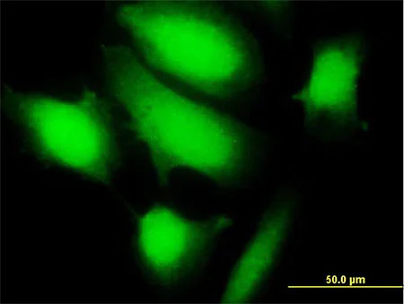 Immunocytochemistry/ Immunofluorescence - Anti-KCTD17 antibody (AB169624)
