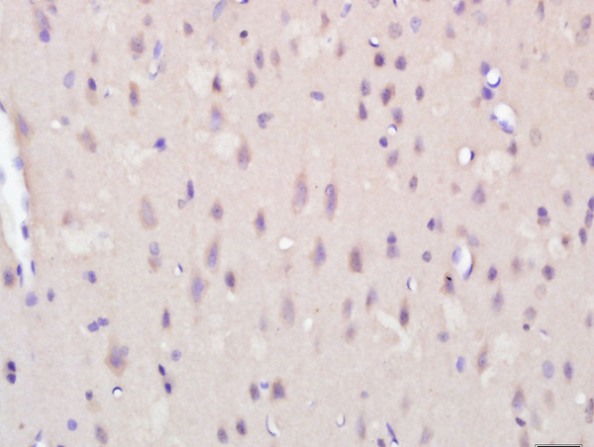 Immunohistochemistry (Formalin/PFA-fixed paraffin-embedded sections) - Anti-KCTD19 antibody (AB215433), expandable thumbnail