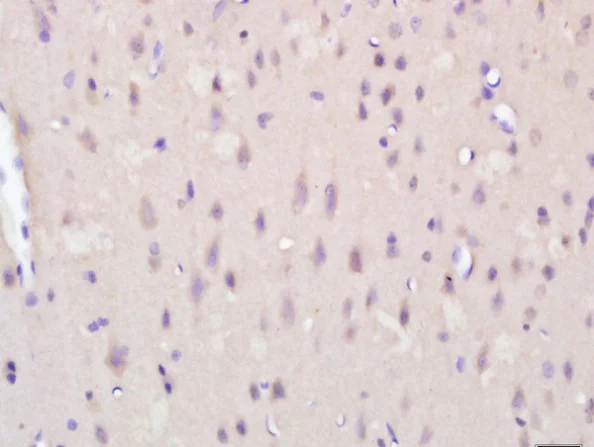Immunohistochemistry (Formalin/PFA-fixed paraffin-embedded sections) - Anti-KCTD19 antibody (AB215433)