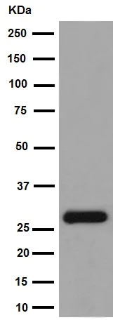 Western blot - Anti-KCTD21 antibody [EPR12873(2)] (AB192259)