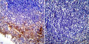 Immunohistochemistry (Formalin/PFA-fixed paraffin-embedded sections) - Anti-KDEL antibody (AB2898), expandable thumbnail