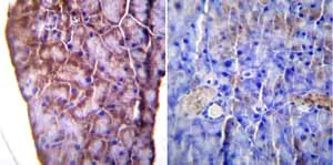Immunohistochemistry (Formalin/PFA-fixed paraffin-embedded sections) - Anti-KDEL antibody (AB2898)