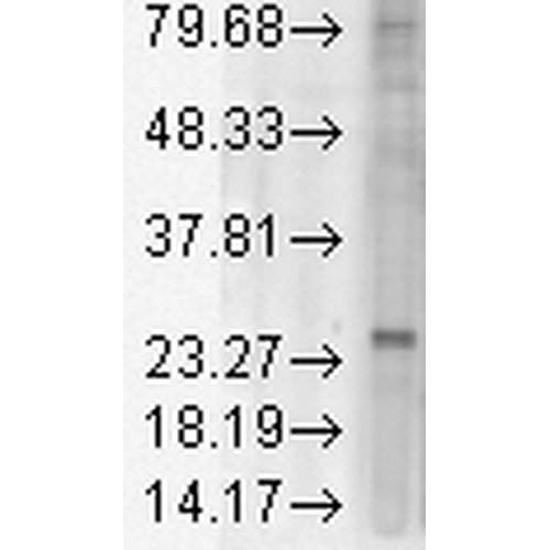 Western blot - Anti-KDEL Receptor antibody [KR-10] (AB69659)