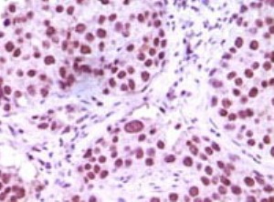 Immunohistochemistry (Formalin/PFA-fixed paraffin-embedded sections) - Anti-KDM1/LSD1 antibody [1B2E5 + 1B2F2] (AB31954), expandable thumbnail