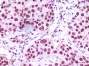 Immunohistochemistry (Formalin/PFA-fixed paraffin-embedded sections) - Anti-KDM1/LSD1 antibody [1B2E5 + 1B2F2] (AB31954)