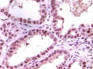 Immunohistochemistry (Formalin/PFA-fixed paraffin-embedded sections) - Anti-KDM1/LSD1 antibody [1B2E5 + 1B2F2] (AB31954), expandable thumbnail
