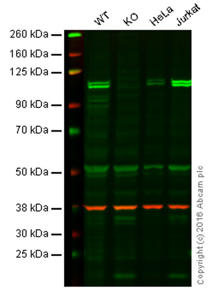 Western blot - Anti-KDM1/LSD1 antibody [1B2E5 + 1B2F2] (AB31954), expandable thumbnail