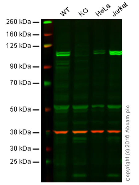 Western blot - Anti-KDM1/LSD1 antibody [1B2E5 + 1B2F2] (AB31954)
