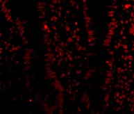 Immunocytochemistry/ Immunofluorescence - Anti-KDM1/LSD1 antibody (AB62582), expandable thumbnail