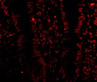 Immunocytochemistry/ Immunofluorescence - Anti-KDM1/LSD1 antibody (AB62582)