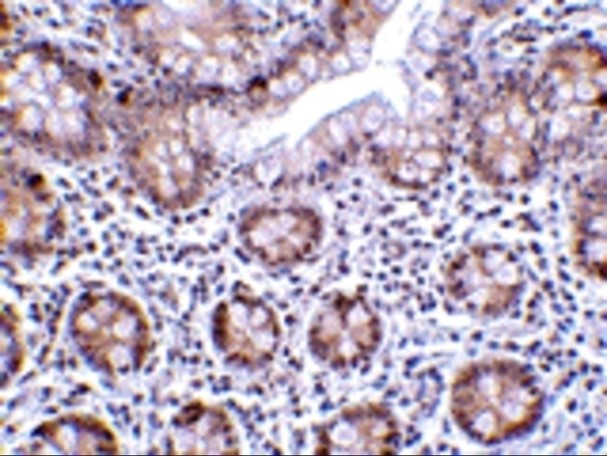 Immunohistochemistry (Formalin/PFA-fixed paraffin-embedded sections) - Anti-KDM1/LSD1 antibody (AB62582), expandable thumbnail