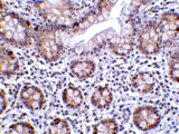 Immunohistochemistry (Formalin/PFA-fixed paraffin-embedded sections) - Anti-KDM1/LSD1 antibody (AB62582)