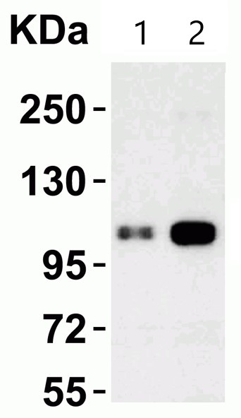 Western blot - Anti-KDM1/LSD1 antibody (AB62582), expandable thumbnail