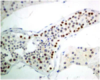 Immunohistochemistry (Formalin/PFA-fixed paraffin-embedded sections) - Anti-KDM1/LSD1 antibody [EPR6825] - BSA and Azide free (AB224270)