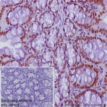 Immunohistochemistry (Formalin/PFA-fixed paraffin-embedded sections) - Anti-KDM1/LSD1 antibody [EPR6825] - Nuclear Marker and ChIP Grade (AB129195)