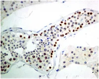 Immunohistochemistry (Formalin/PFA-fixed paraffin-embedded sections) - Anti-KDM1/LSD1 antibody [EPR6825] - Nuclear Marker and ChIP Grade (AB129195)