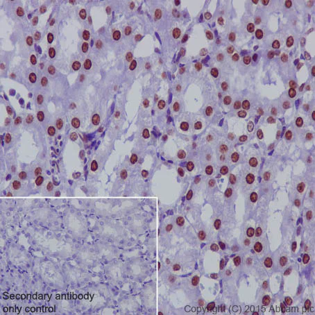 Immunohistochemistry (Formalin/PFA-fixed paraffin-embedded sections) - Anti-KDM1/LSD1 antibody [EPR6825] - Nuclear Marker and ChIP Grade (AB129195)
