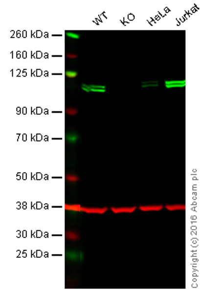 Western blot - Anti-KDM1/LSD1 antibody [EPR6825] - Nuclear Marker and ChIP Grade (AB129195)