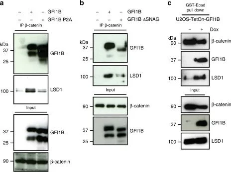 Western blot - Anti-KDM1/LSD1 antibody - Nuclear Marker (AB17721)