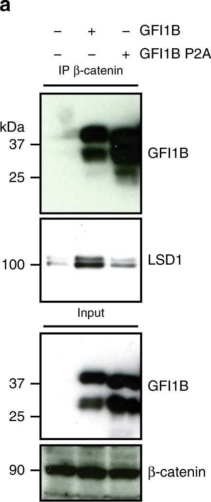 Western blot - Anti-KDM1/LSD1 antibody - Nuclear Marker (AB17721)