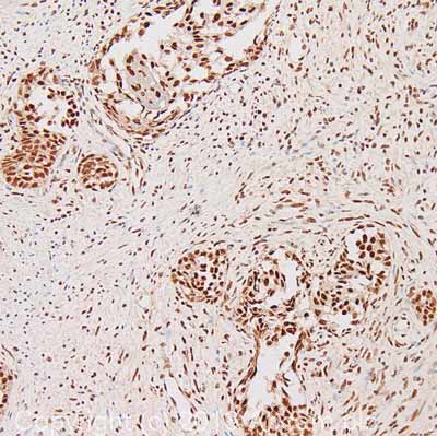 Immunohistochemistry (Formalin/PFA-fixed paraffin-embedded sections) - Anti-KDM1/LSD1 antibody - Nuclear Marker (AB37165), expandable thumbnail