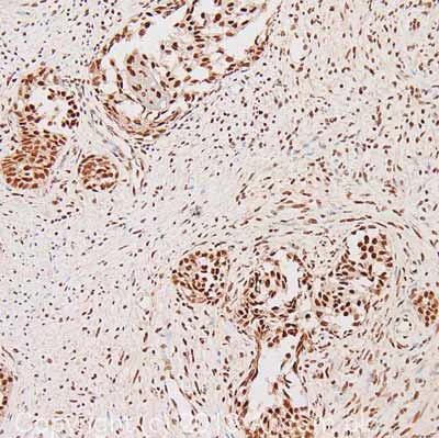 Immunohistochemistry (Formalin/PFA-fixed paraffin-embedded sections) - Anti-KDM1/LSD1 antibody - Nuclear Marker (AB37165)