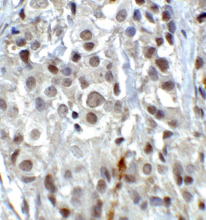 Immunohistochemistry (Formalin/PFA-fixed paraffin-embedded sections) - Anti-KDM1/LSD1 antibody - Nuclear Marker (AB37165), expandable thumbnail