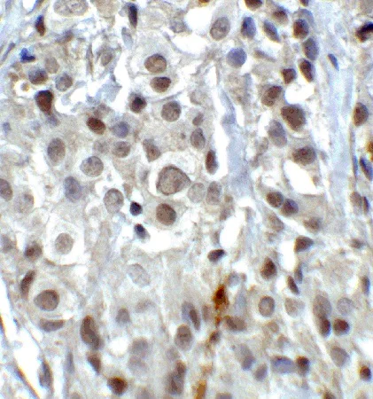 Immunohistochemistry (Formalin/PFA-fixed paraffin-embedded sections) - Anti-KDM1/LSD1 antibody - Nuclear Marker (AB37165)
