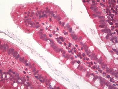 Immunohistochemistry (Formalin/PFA-fixed paraffin-embedded sections) - Anti-KDM2A antibody (AB174693), expandable thumbnail