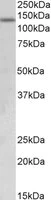 Western blot - Anti-KDM2A antibody (AB174693)
