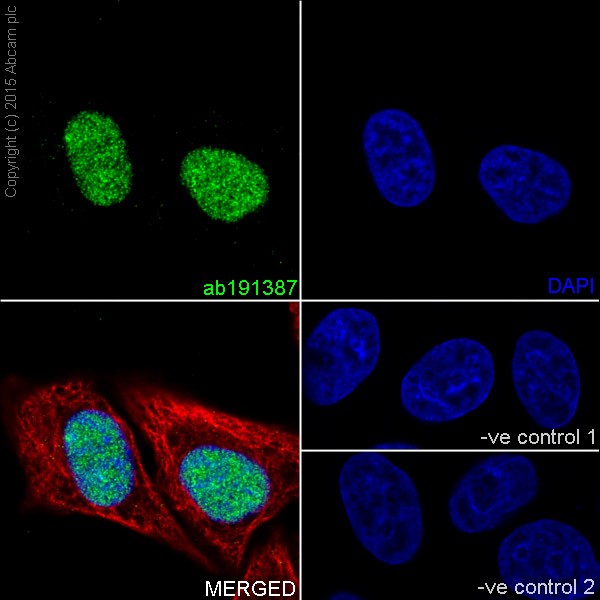 Immunocytochemistry/ Immunofluorescence - Anti-KDM2A antibody [EPR18602] (AB191387), expandable thumbnail