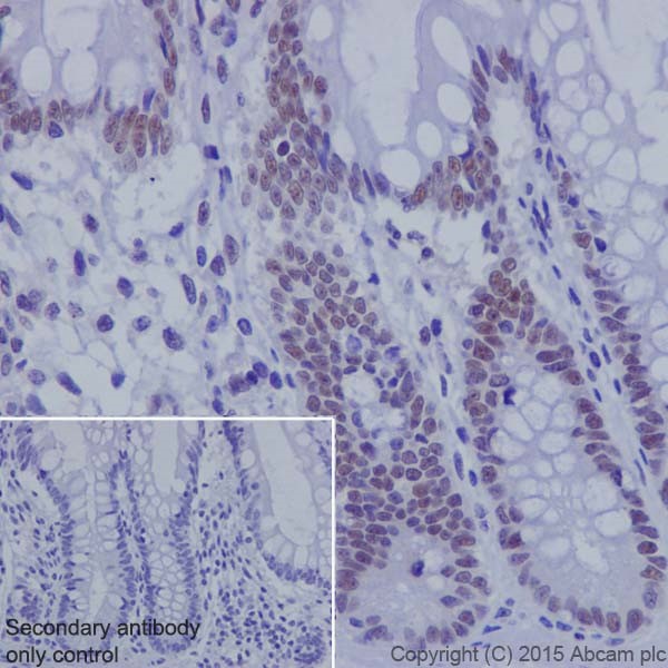 Immunohistochemistry (Formalin/PFA-fixed paraffin-embedded sections) - Anti-KDM2A antibody [EPR18602] (AB191387), expandable thumbnail