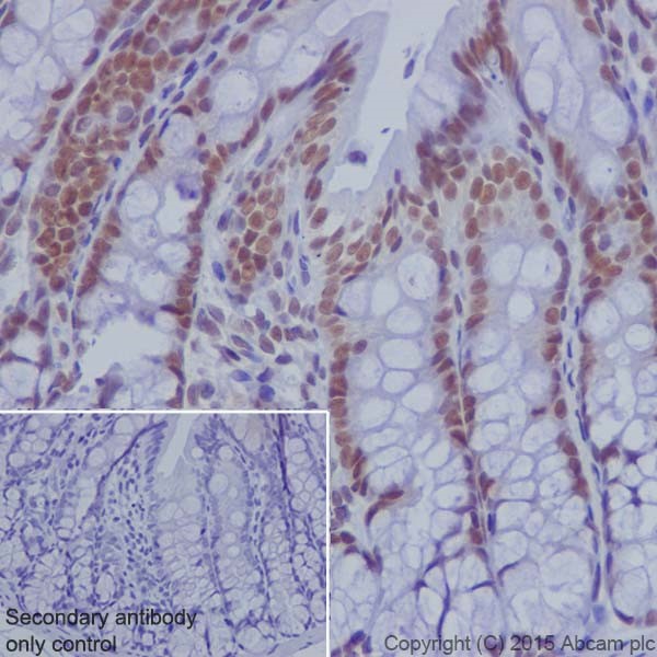 Immunohistochemistry (Formalin/PFA-fixed paraffin-embedded sections) - Anti-KDM2A antibody [EPR18602] (ab191387), expandable thumbnail