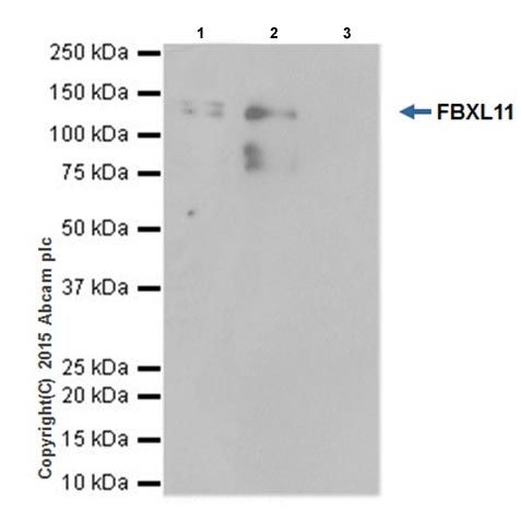 Immunoprecipitation - Anti-KDM2A antibody [EPR18602] (ab191387), expandable thumbnail
