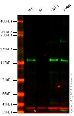 Western blot - Anti-KDM2A antibody [EPR18602] (AB191387), expandable thumbnail