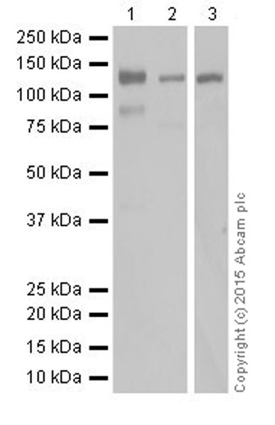 Western blot - Anti-KDM2A antibody [EPR18602] (AB191387), expandable thumbnail