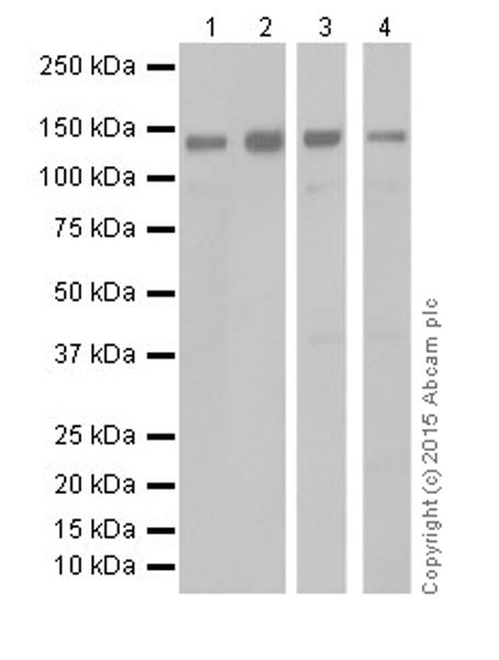 Western blot - Anti-KDM2A antibody [EPR18602] (ab191387), expandable thumbnail