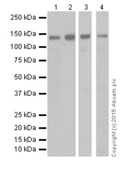 Western blot - Anti-KDM2A antibody [EPR18602] (AB191387)