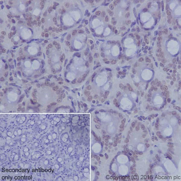 Immunohistochemistry (Formalin/PFA-fixed paraffin-embedded sections) - Anti-KDM2A antibody [EPR18602] - BSA and Azide free (AB238945)