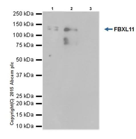 Immunoprecipitation - Anti-KDM2A antibody [EPR18602] - BSA and Azide free (AB238945)