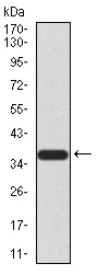 Western blot - Anti-KDM2B antibody [6F6G11] (AB234082)