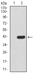 Western blot - Anti-KDM2B antibody [6F6G11] (AB234082)