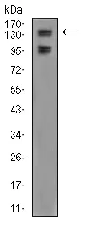 Western blot - Anti-KDM2B antibody [6F6G11] (AB234082)