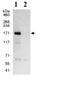 Immunoprecipitation - Anti-KDM3A / JHDM2A antibody (AB80598), expandable thumbnail