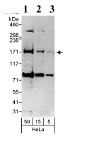 Western blot - Anti-KDM3A / JHDM2A antibody (AB80598)