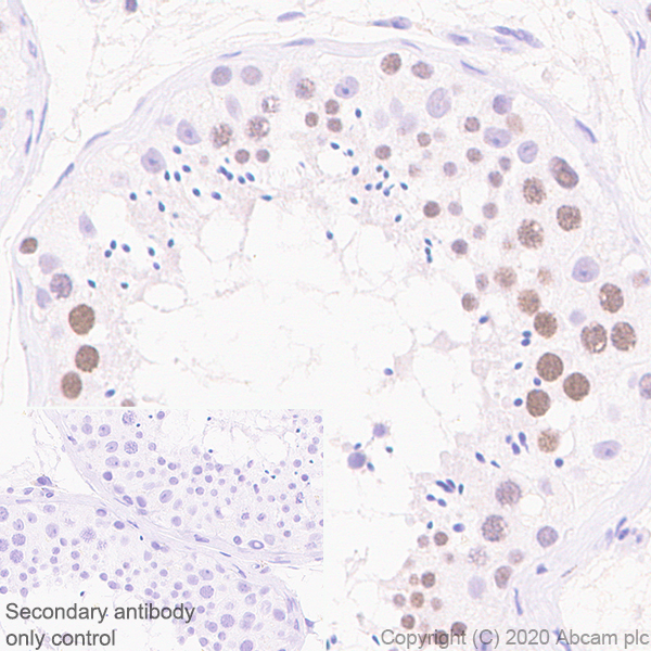 Immunohistochemistry (Formalin/PFA-fixed paraffin-embedded sections) - Anti-KDM3A / JHDM2A antibody [EPR18875-106] (ab243641), expandable thumbnail