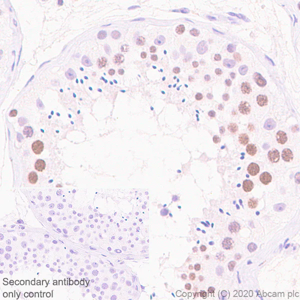 Immunohistochemistry (Formalin/PFA-fixed paraffin-embedded sections) - Anti-KDM3A / JHDM2A antibody [EPR18875-106] (AB243641)