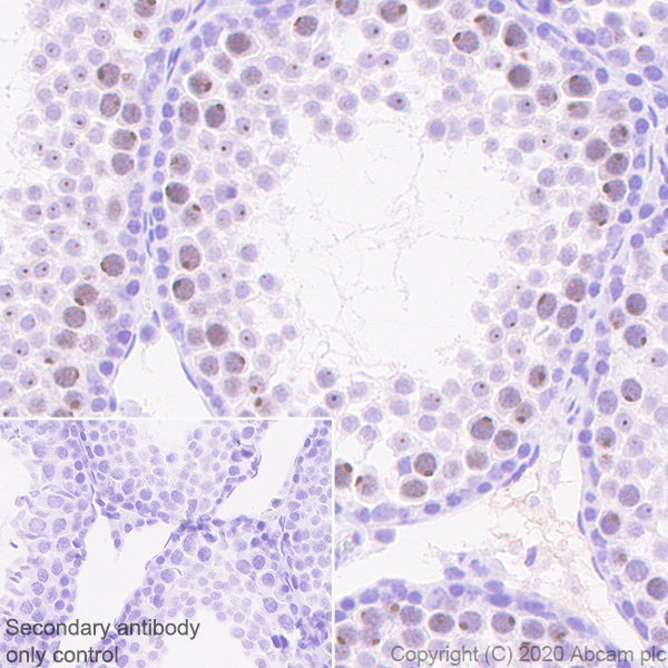Immunohistochemistry (Formalin/PFA-fixed paraffin-embedded sections) - Anti-KDM3A / JHDM2A antibody [EPR18875-106] (AB243641), expandable thumbnail