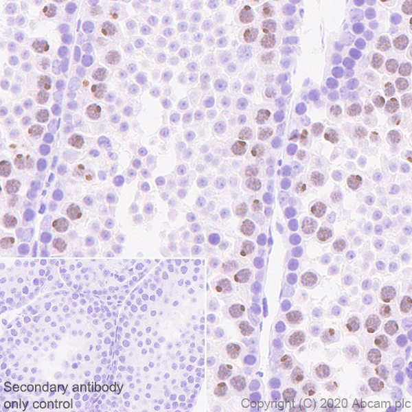 Immunohistochemistry (Formalin/PFA-fixed paraffin-embedded sections) - Anti-KDM3A / JHDM2A antibody [EPR18875-106] (ab243641), expandable thumbnail