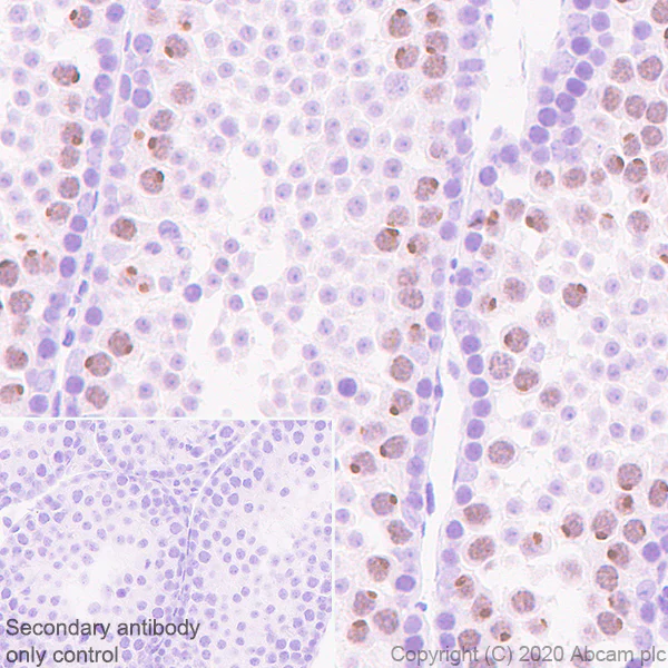 Immunohistochemistry (Formalin/PFA-fixed paraffin-embedded sections) - Anti-KDM3A / JHDM2A antibody [EPR18875-106] (AB243641)